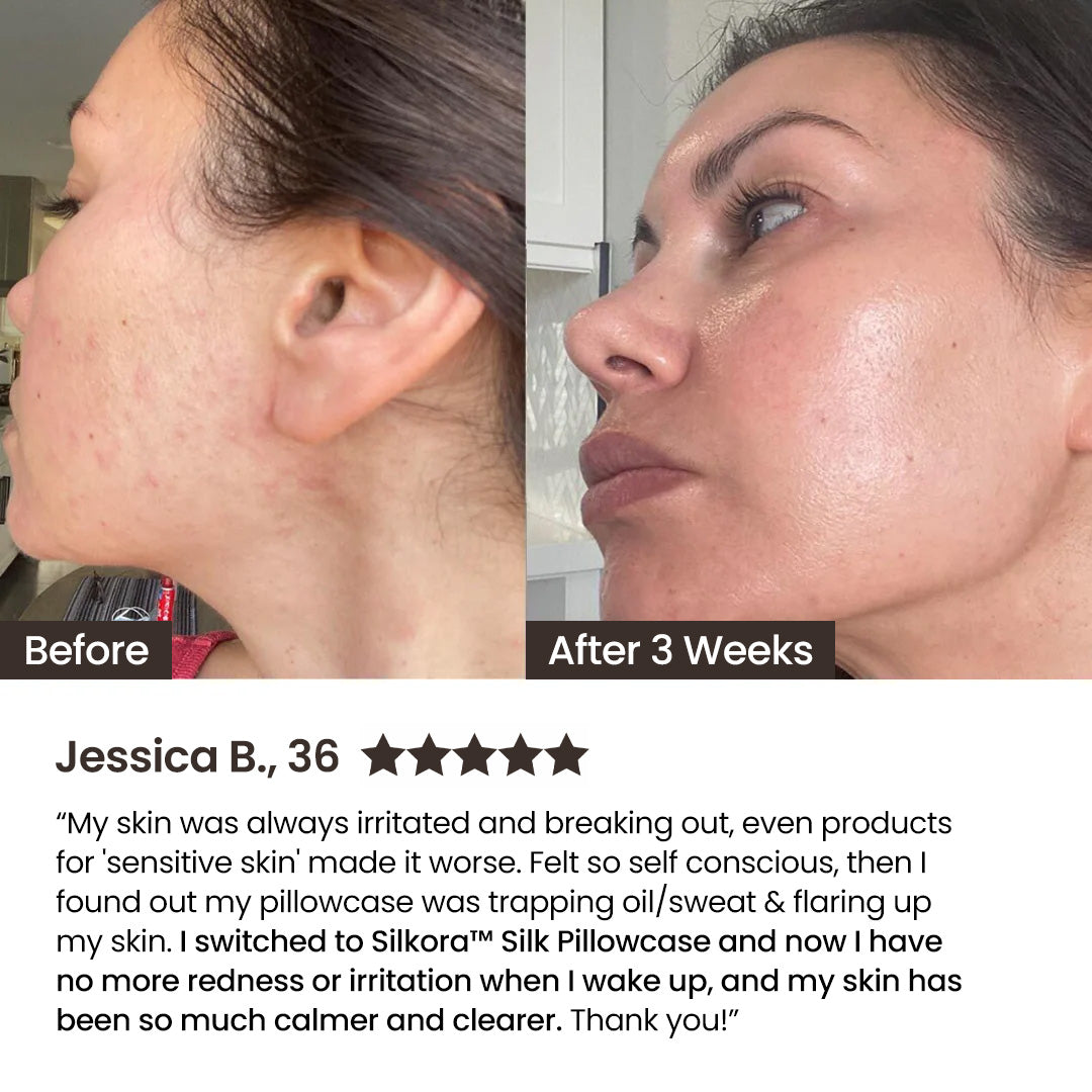 silkora™ Signature Pillowcase